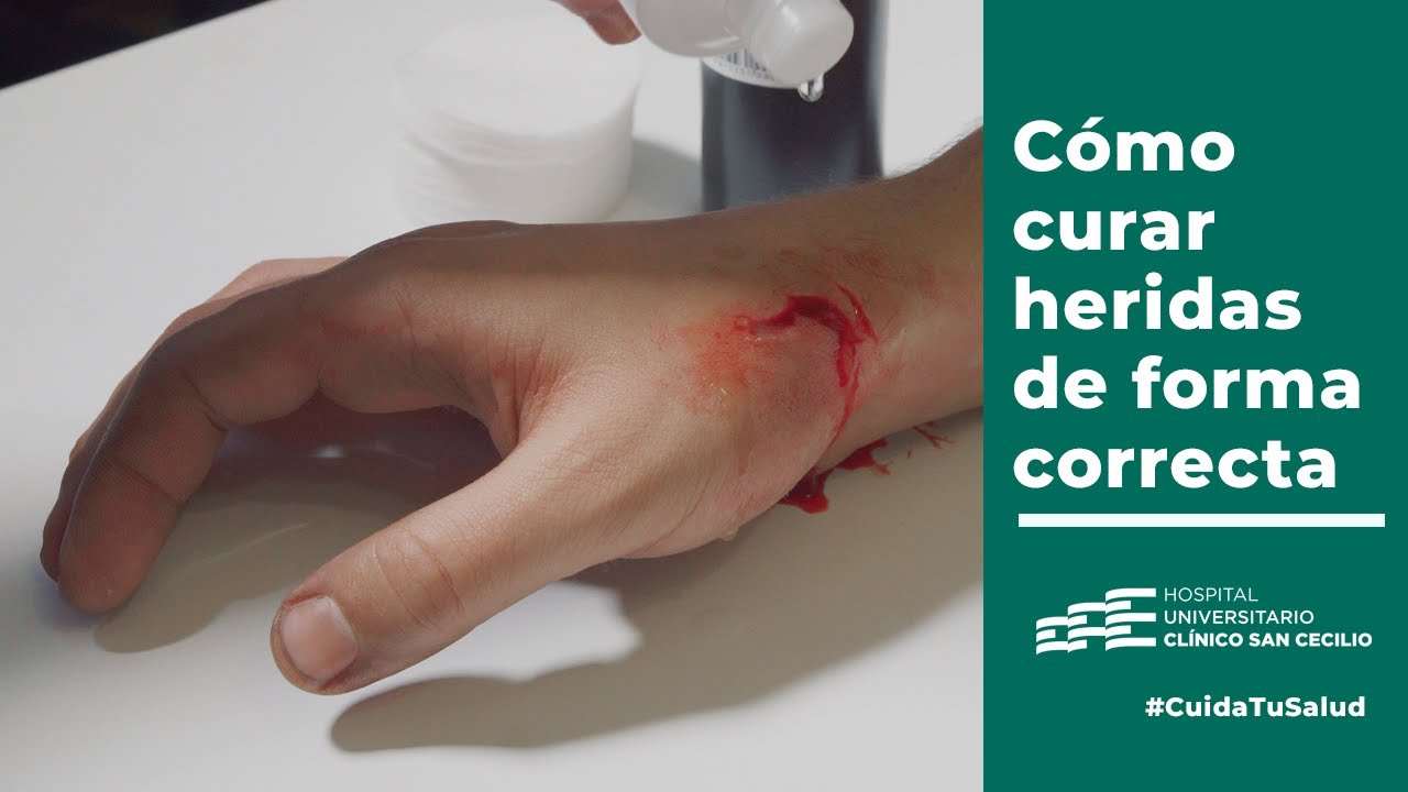 Heridas leves en España: qué son, cuándo ir a urgencias y cómo tratarlas