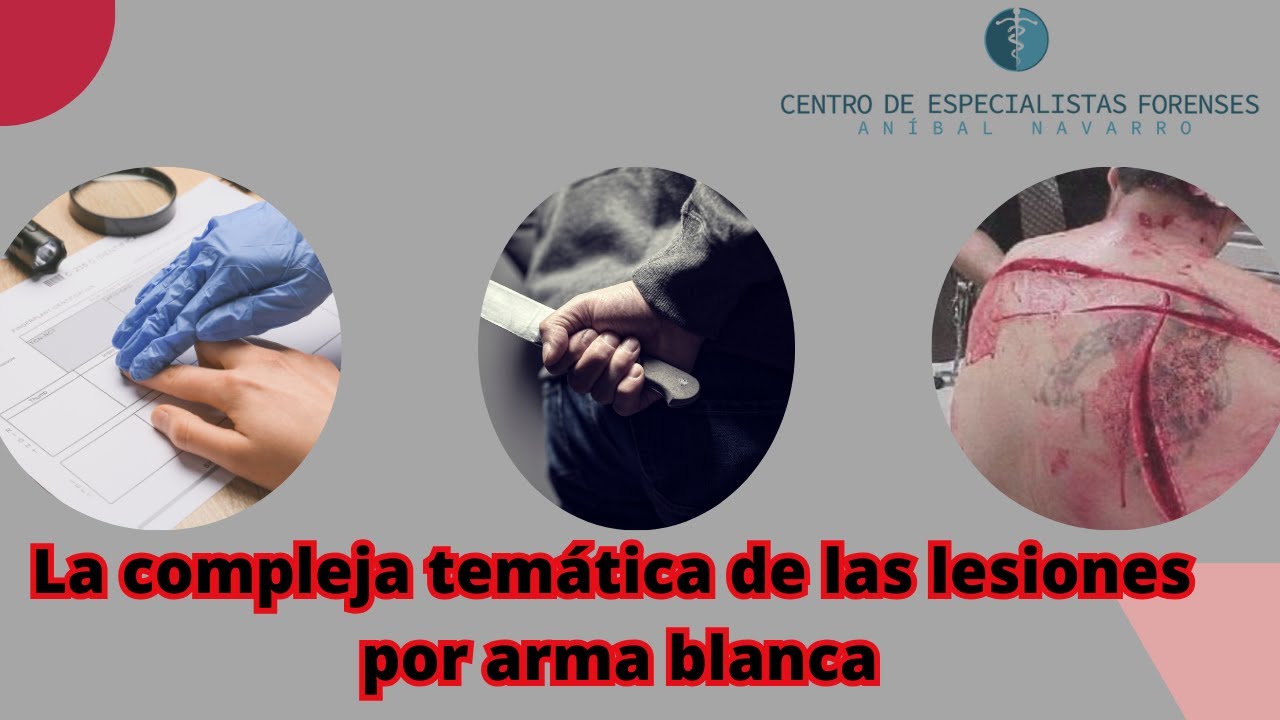 Heridas por arma blanca en España: qué hacer, síntomas y cuándo acudir a Urgencias
